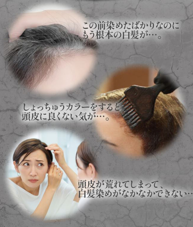 白髪ケアの悩み「生際」「頭皮の荒れ」